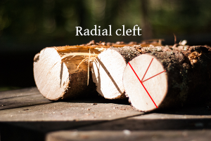 radial_cleft